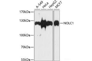 Western blot analysis of extracts of various cell lines using NOLC1 Polyclonal Antibody at dilution of 1:1000. (NOLC1 Antikörper)