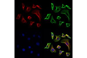 ABIN6261678 and ABIN6268891 staining Hela cells by IF/ICC at 1:100(red). (FAP Antikörper  (Internal Region))