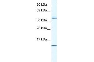 Human Liver; WB Suggested Anti-TSFM Antibody Titration: 0. (TSFM Antikörper  (N-Term))