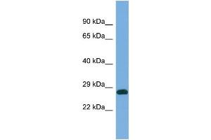 Western Blotting (WB) image for anti-Prune Exopolyphosphatase (PRUNE) (C-Term) antibody (ABIN2787268) (PRUNE Antikörper  (C-Term))
