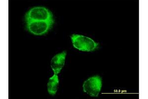 Immunofluorescence of purified MaxPab antibody to SRGAP1 on HeLa cell. (SRGAP1 Antikörper  (AA 1-1085))