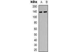 Western blot analysis of DZIP3 expression in HEK293T (A), A431 (B) whole cell lysates. (DZIP3 Antikörper)