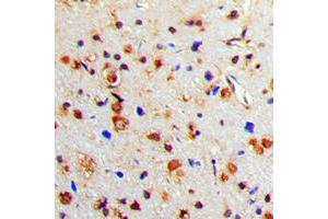 Immunohistochemical analysis of Tyrosine Hydroxylase (pS71) staining in human brain formalin fixed paraffin embedded tissue section. (Tyrosine Hydroxylase Antikörper  (N-Term, pSer71))