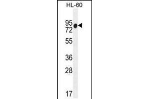 Western blot analysis in HL-60 cell line lysates (35ug/lane). (ZNF665 Antikörper  (N-Term))
