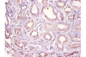 Immunohistochemistry of paraffin-embedded human kidney using DHRS9 antibody at dilution of 1:100.