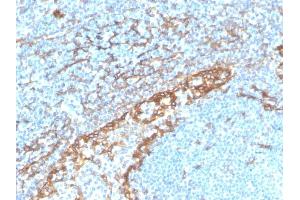 Formalin-fixed, paraffin-embedded human tonsil stained with Podoplanin Recombinant Rabbit Monoclonal Antibody (PDPN/4009R). (Rekombinanter Podoplanin Antikörper  (AA 1-100))