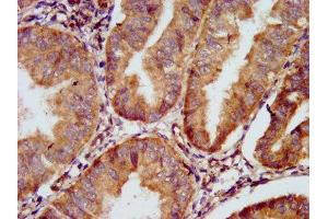 Immunohistochemistry (IHC) image for anti-Gap Junction Protein, delta 2, 36kDa (GJD2) (AA 99-197) antibody (ABIN7153633)