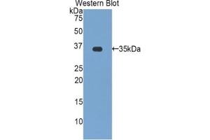 Detection of Recombinant zAP70, Human using Polyclonal Antibody to Zeta Chain Associated Protein Kinase 70 kDa (zAP70) (ZAP70 Antikörper  (AA 337-600))