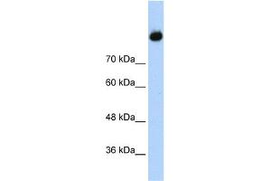 WB Suggested Anti-C2 Antibody Titration:  1. (Complement C2 Antikörper  (Middle Region))