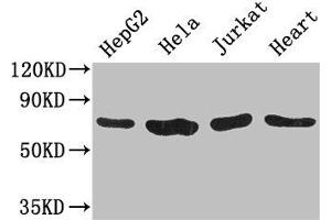 Western Blot Positive WB detected in: HepG2 whole cell lysate, Hela whole cell lysate, Jurkat whole cell lysate, Mouse heart tissue All lanes: CHFR antibody at 3. (CHFR Antikörper  (AA 141-422))