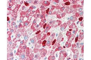 Immunohistochemistry (IHC) image for anti-Cytochrome P450, Family 3, Subfamily A, Polypeptide 4 (CYP3A4) (AA 254-303) antibody (ABIN6754943)
