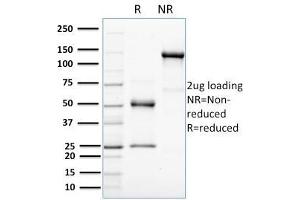 SDS-PAGE Analysis Purified HER-4 / ERBB4 Mouse Monoclonal Antibody (HFR-1). (ERBB4 Antikörper  (AA 1116-1269))