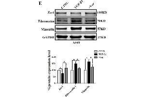 Inhibiting the co-transcription complex YAP/TEAD reverses A549 cell proliferation, migration, and invasion induced by TGF-β1. (GAPDH Antikörper)