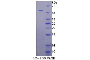 SDS-PAGE analysis of Mouse RNF4 Protein. (RNF4 Protein)