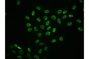 Immunofluorescence staining of Hela cells with ABIN7127707 at 1:100,counter-stained with DAPI. (Rekombinanter ERK1 Antikörper  (pThr185, pThr202))