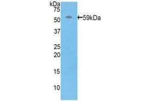Detection of Recombinant PRF1, Human using Polyclonal Antibody to Perforin 1 (PRF1) (Perforin 1 Antikörper  (AA 32-316))
