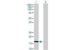 Lane 1: MRPL50 transfected lysate ( 18. (MRPL50 293T Cell Transient Overexpression Lysate(Denatured))