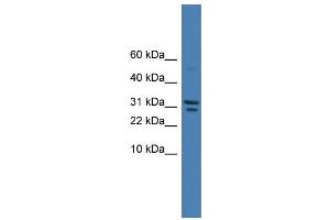 WB Suggested Anti-SPINT2 Antibody Titration: 0. (SPINT2 Antikörper  (C-Term))
