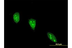 Immunofluorescence of monoclonal antibody to ANGPTL7 on HeLa cell. (ANGPTL7 Antikörper  (AA 27-126))