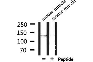 Western blot analysis of extracts from mouse muscle, using RBM16 Antibody. (RBM16 Antikörper  (Internal Region))