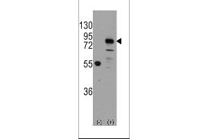 Western blot analysis of CDH9 using rabbit polyclonal CDH9 Antibody using 293 cell lysates (2 ug/lane) either nontransfected (Lane 1) or transiently transfected with the CDH9 gene (Lane 2).