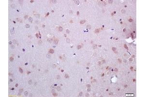 Formalin-fixed and paraffin embedded rat brain labeled with Anti-ARHI Polyclonal Antibody, Unconjugated (ABIN681448) at 1:200 followed by conjugation to the secondary antibody and DAB staining (DIRAS3 Antikörper  (AA 131-229))