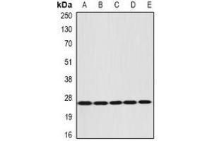 Western blot analysis of DIRAS3 expression in NIH3T3 (A), mouse liver (B), mouse brain (C), rat liver (D), rat kidney (E) whole cell lysates. (DIRAS3 Antikörper)