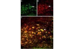 Multiplex staining of GluN2A and GluN2B in mouse deep cerebellar nucleusImmunohistochemical staining of perfusion-fixed frozen mouse brain sections using Anti-NMDAR2B (GluN2B) (extracellular)-ATTO Fluor-594 Antibody (ABIN7043231), (1:60) and Anti-NMDAR2A (GluN2A) (extracellular) Antibody (ABIN7043228, ABIN7044324 and ABIN7044325), (1:200). (Glutamate Receptor, Ionotropic, N-Methyl D-Aspartate 2a (GRIN2A) Peptid)