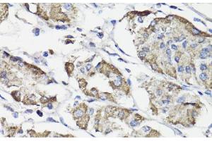Immunohistochemistry of paraffin-embedded Human stomach using WASF3 Polyclonal Antibody at dilution of 1:100 (40x lens).