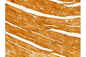 ABIN6263218 and ABIN6273007 at 1/100 staining Mouse heart tissue by IHC-P. (Melanophilin Antikörper  (C-Term))