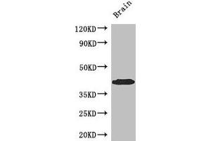 Western Blot Positive WB detected in: Mouse brain tissue All lanes: SPDEF antibody at 3 μg/mL Secondary Goat polyclonal to rabbit IgG at 1/50000 dilution Predicted band size: 38, 36 kDa Observed band size: 38 kDa (SPDEF/PSE Antikörper  (AA 145-247))