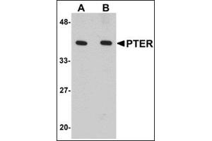 Western blot analysis of PTER in human kidney tissue lysate with this product at (A) 1 and (B) 2 μg/ml.