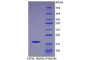 SDS-PAGE (SDS) image for Chemokine (C-C Motif) Ligand 8 (CCL8) (AA 1-99) protein (His tag) (ABIN1821557)
