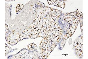Immunoperoxidase of monoclonal antibody to RUNX2 on formalin-fixed paraffin-embedded human placenta. (RUNX2 Antikörper  (AA 251-350))