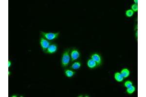 Immunofluorescent staining of HT29 cells using anti-AK1 mouse monoclonal antibody (ABIN2452270). (Adenylate Kinase 1 Antikörper)
