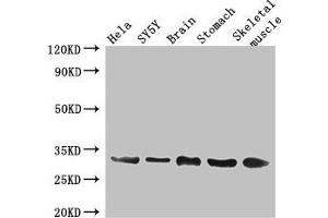Connexin 31 Antikörper  (AA 211-270)