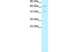 WB Suggested Anti-FOXP3 Antibody Titration:  5. (FOXP3 Antikörper  (N-Term))