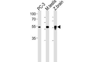 Western Blotting (WB) image for anti-DMRT-Like Family A2 (DMRTA2) antibody (ABIN3001241) (DMRTA2 Antikörper)