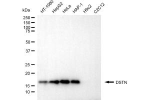 Western blotting analysis using DSTN antibody (ABIN7798320).