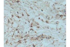 Used in DAB staining on fromalin fixed paraffin- embedded kidney tissue (PDGF-BB Homodimer (AA 82-190) Antikörper)