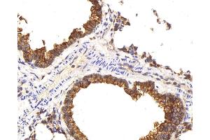 Immunohistochemistry analysis of paraffin-embedded mouse lung using CK-8 Polyclonal Antibody at dilution of 1:200. (KRT8 Antikörper)