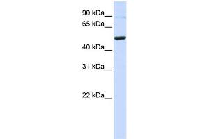 WB Suggested Anti-TINF2 Antibody Titration: 0.