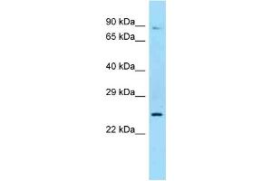 Western Blotting (WB) image for anti-Sex Hormone Binding Globulin (SHBG) (N-Term) antibody (ABIN2789332) (SHBG Antikörper  (N-Term))