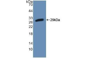 Detection of Recombinant PFKP, Mouse using Polyclonal Antibody to Phosphofructokinase, Platelet (PFKP) (PFKP Antikörper  (AA 247-473))