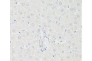 Immunohistochemistry of paraffin-embedded Rat liver using KAT2A Polyclonal Antibody at dilution of 1:100 (40x lens). (KAT2A Antikörper)