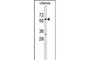 LEMD2 Antibody (N-term) (ABIN1538922 and ABIN2838288) western blot analysis in Uterus tissue lysates (35 μg/lane).
