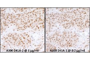 Immunohistochemistry (IHC) image for anti-Replication Protein A1, 70kDa (RPA1) (AA 350-400) antibody (ABIN7453556) (RPA1 Antikörper  (AA 350-400))