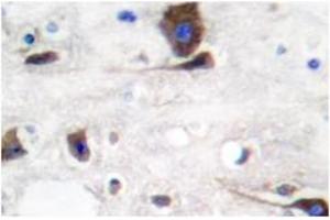 Image no. 1 for anti-Neuregulin 1 (NRG1) antibody (ABIN265466) (Neuregulin 1 Antikörper)