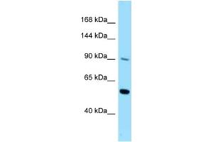 WB Suggested Anti-CSF2RB Antibody Titration: 1. (CD131 Antikörper  (C-Term))