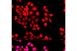Immunofluorescence analysis of A549 cells using STXBP2 Polyclonal Antibody (STXBP2 Antikörper)